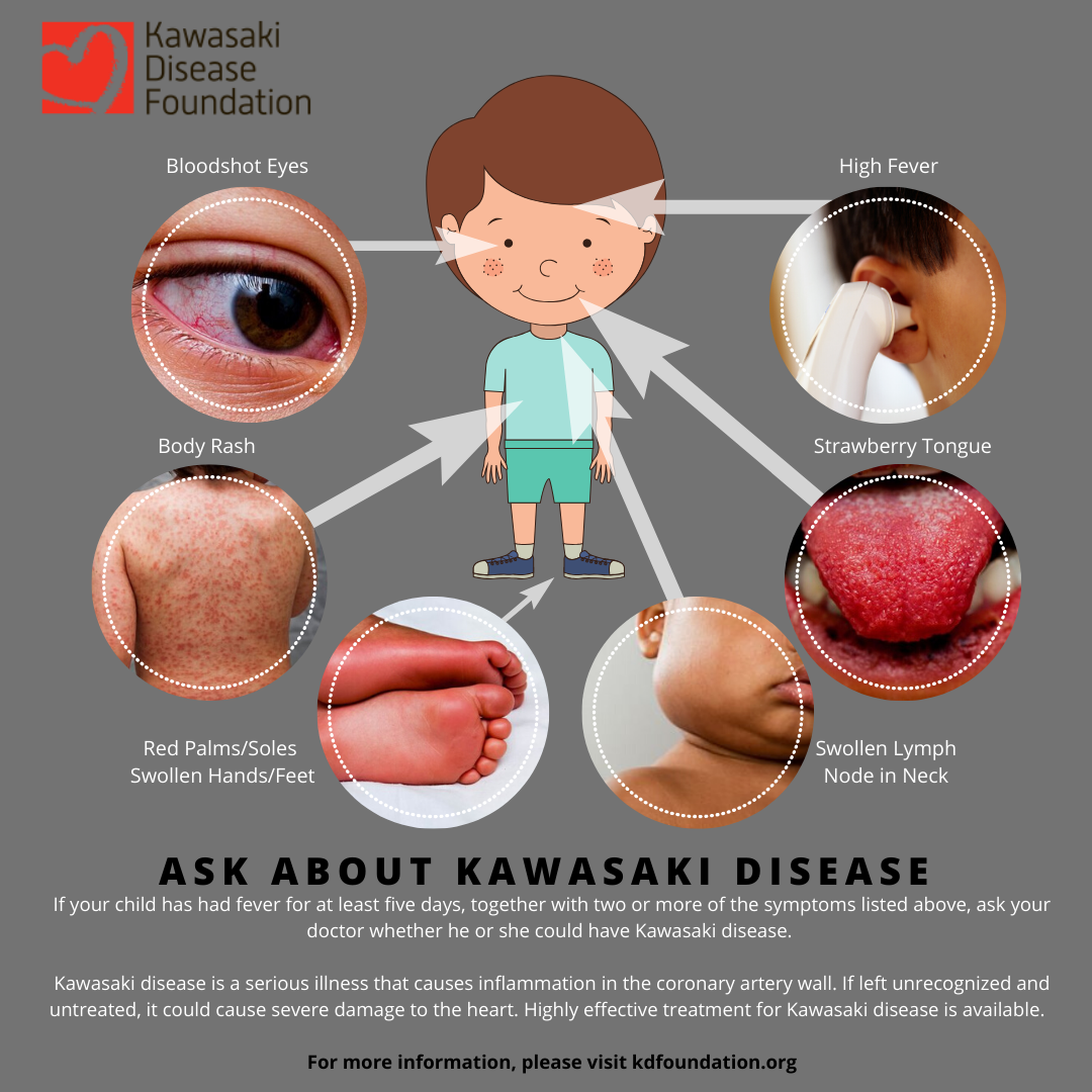 KD Day Social Media Guide | Kawasaki Disease Foundation