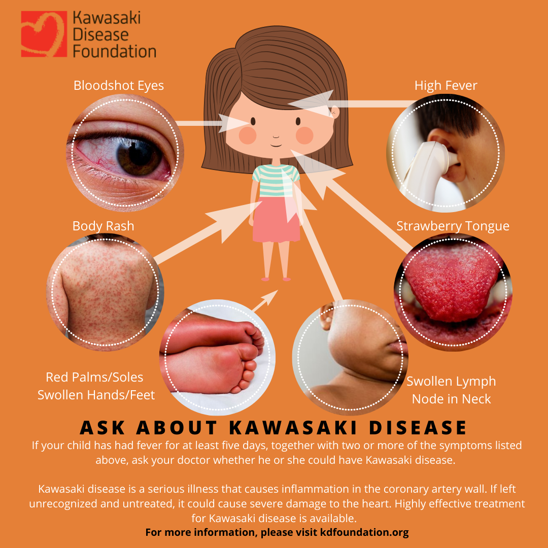 Kawasaki Disease: Understanding the Rare Illness in Children | Kawasaki ...