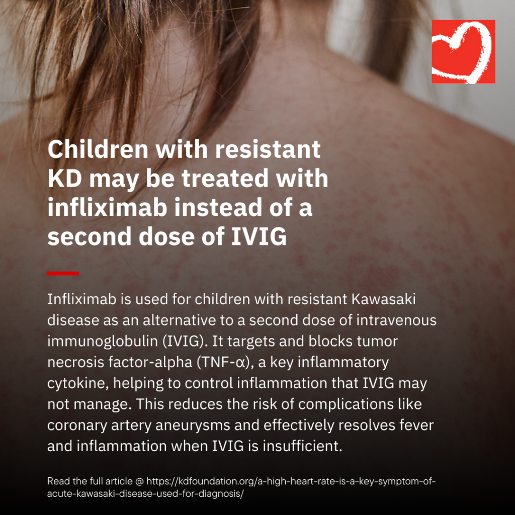 Children with resistant KD may be treated with infliximab instead of a second dose of IVIG